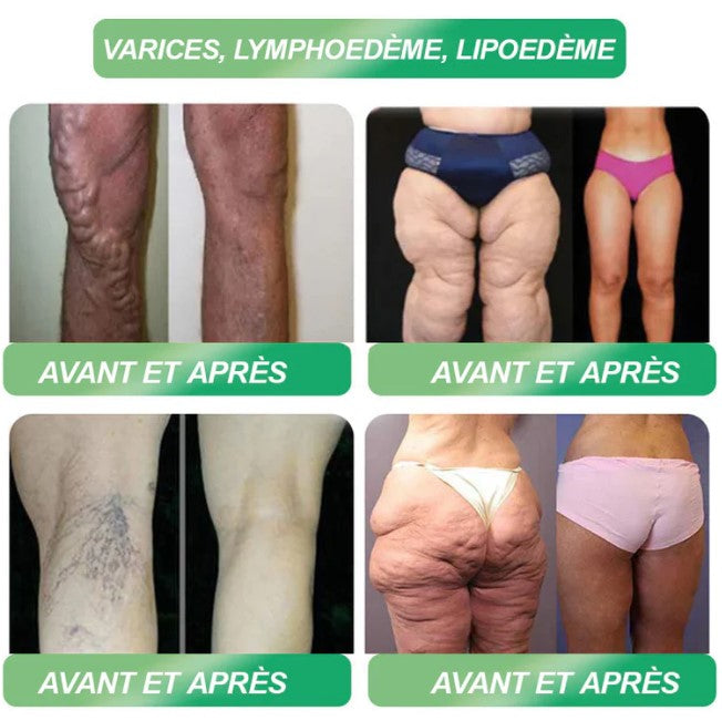GLP-1 Six en Un : le secret pour mincir naturellement