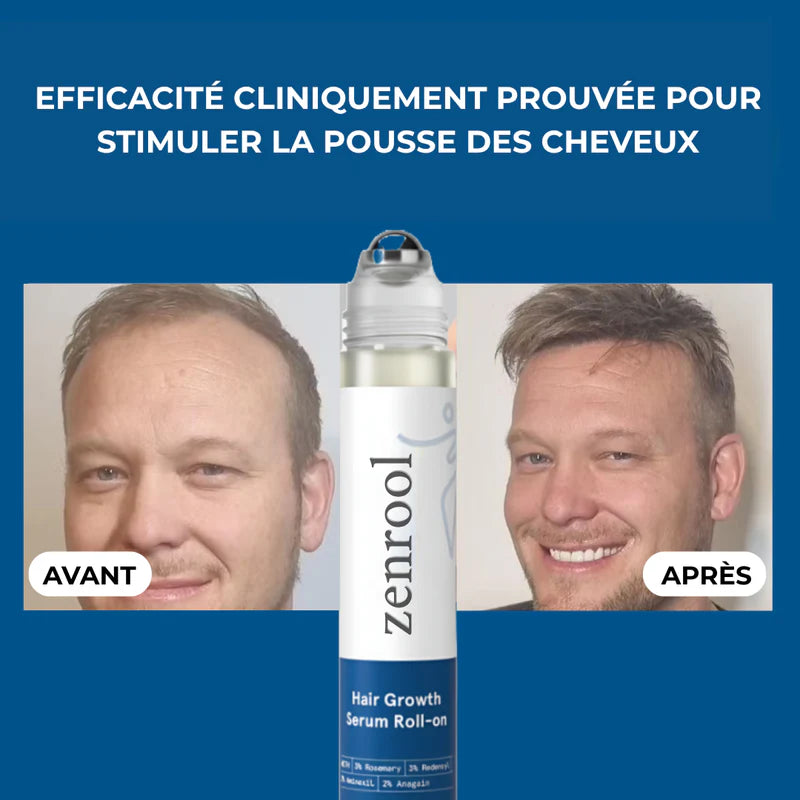 Sérum Roll-On Anti-Chute et Repousse