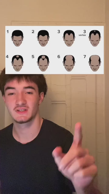 Sérum Roll-On Anti-Chute et Repousse